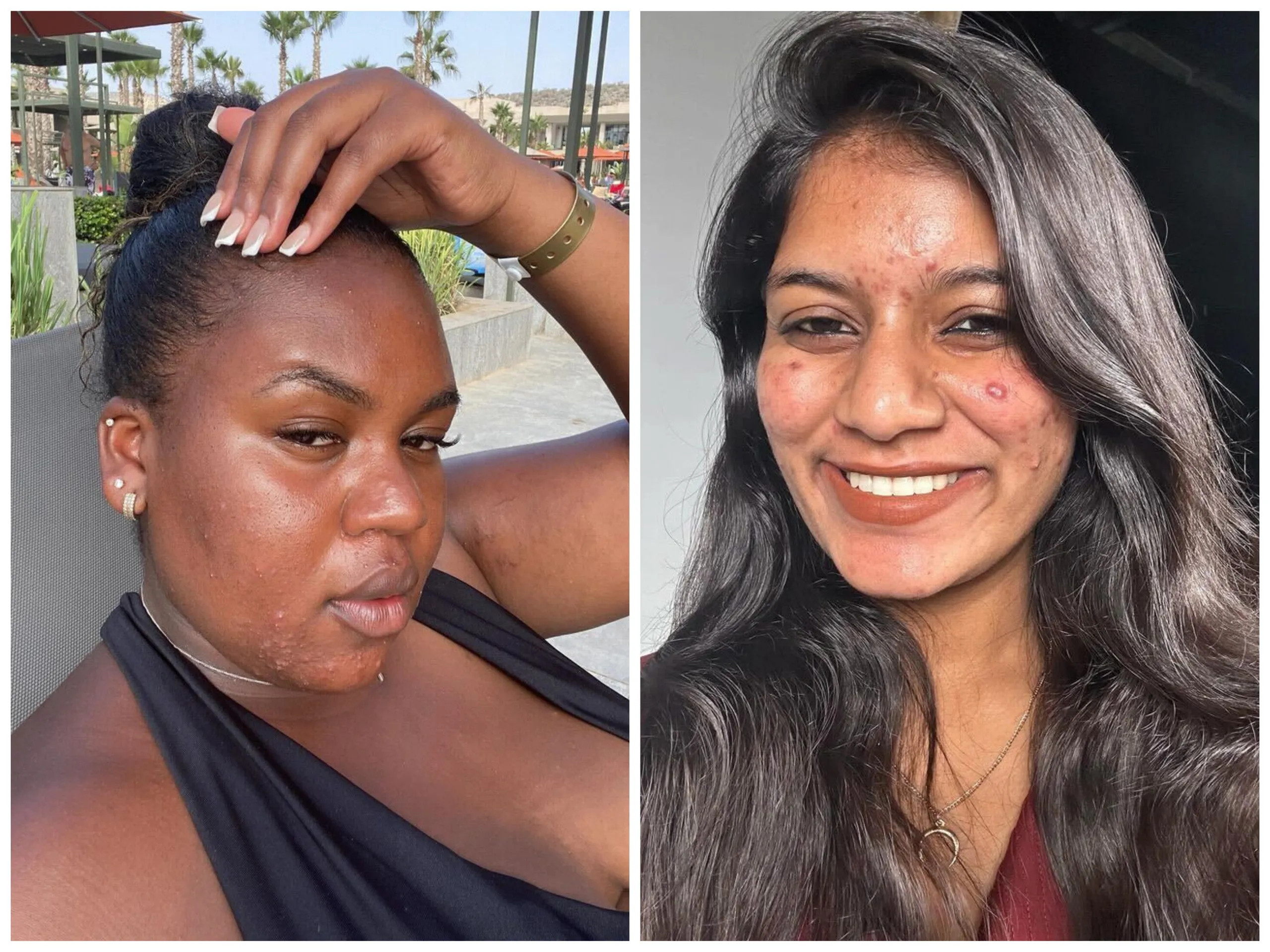 Before and After Results