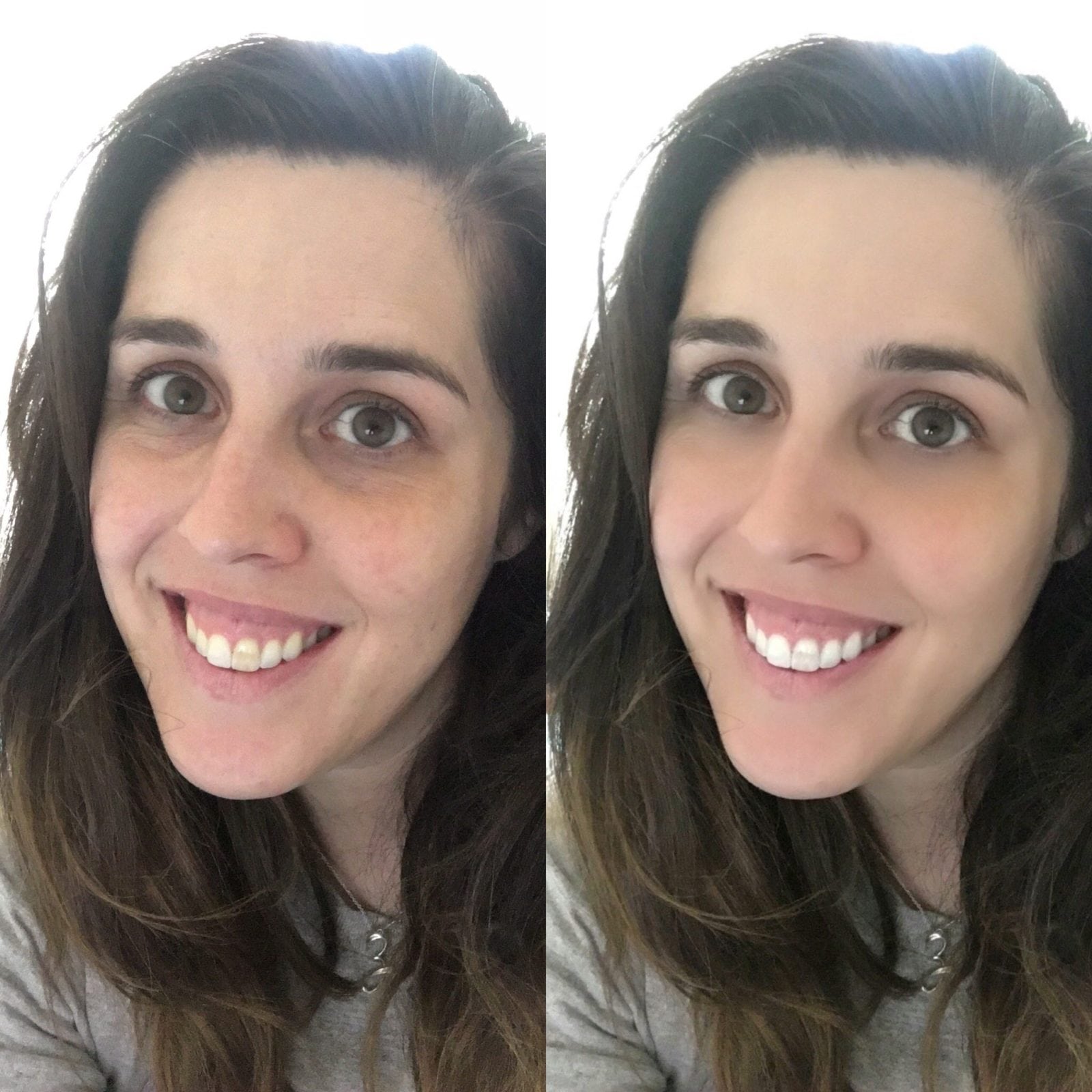 Before and After Results